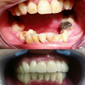 Digital Dentistry